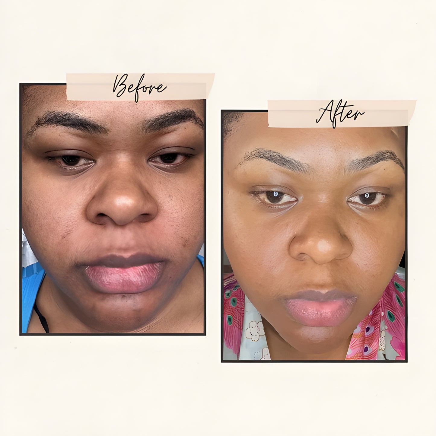 Exnotic™—Gel With Vitamin C Capsule Cream