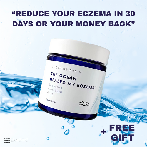 Exnotic™ -The Ocean Healed My Eczema