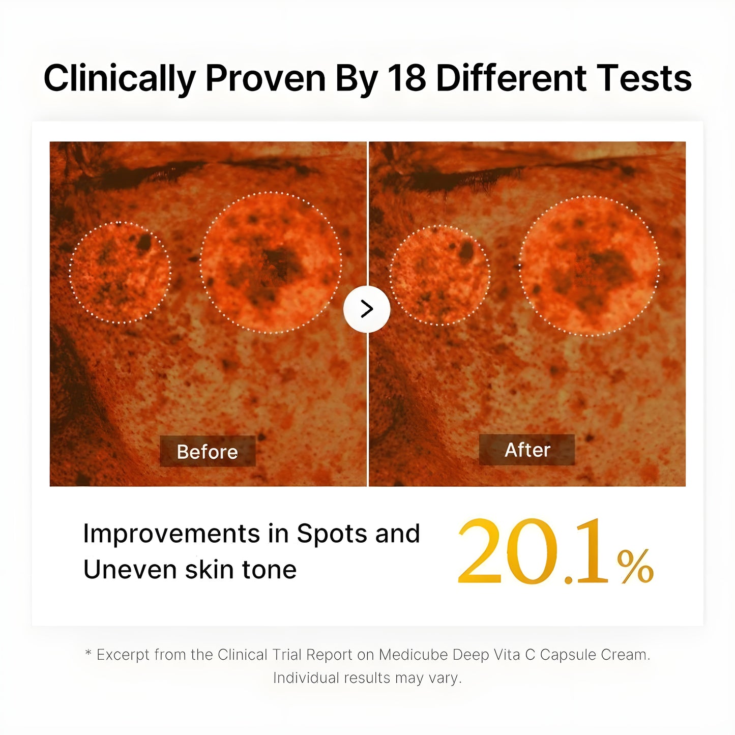 Exnotic™—Gel With Vitamin C Capsule Cream